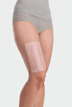 Juzo ScarPad, application on the thigh