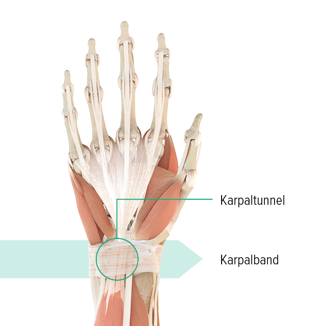 Anatomische Zeichnung - Linke Hand Anatomie-Grafik der linken Hand mit Markierung des Karpaltunnels und des Karpalbandes