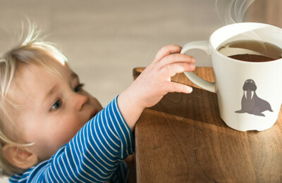 Tag des brandverletzten Kindes: Tee tut weh!