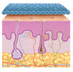 Cicatrice aplatie sous le tricot de compression