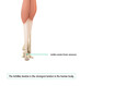 Achilles tendon