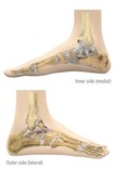 View of foot from two sides