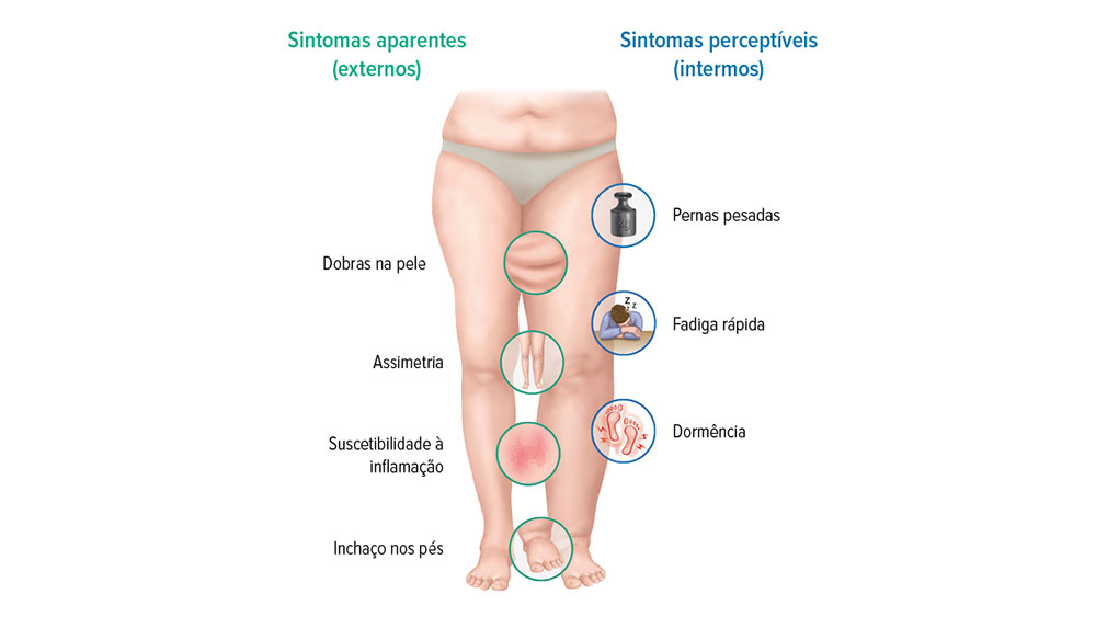 Sintomas do linfedema