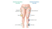 Diagram lipoedema symptoms