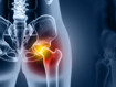Blue X-ray image of the hip joint with marking in the area of the hip joint