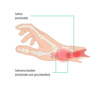 Auf dieser Grafik erkennt man die Anatomie einer Hand, die Sehnen verlaufen durch Sehnenscheiden in der Hand