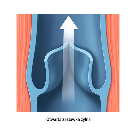 otwarta zastawka żylna otwarta zastawka żylna