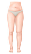 Stadie I – Spontant reversibelt stadie