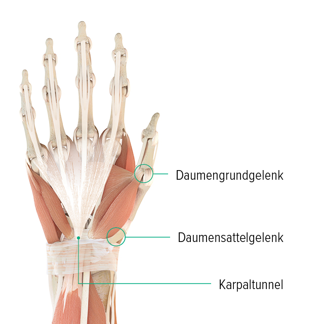 Anatomie-Grafik einer Hand: man erkennt dort das Daumengrundgelenk, Daumensattelgelenk und wo sich der Karpaltunnel befindet