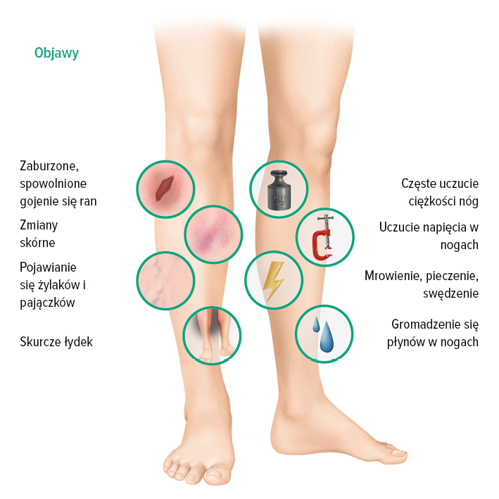 Objawy przypadku PNŻ Objawy przypadku PNŻ